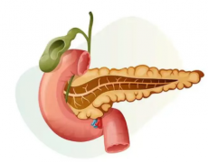 阻击癌中之王 ，洛阳白马医院普外科成功救治高龄胰腺癌患者