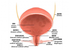 经腹腔镜下右肾输尿管部分膀胱切除术，为高龄肿瘤患者带来新希望