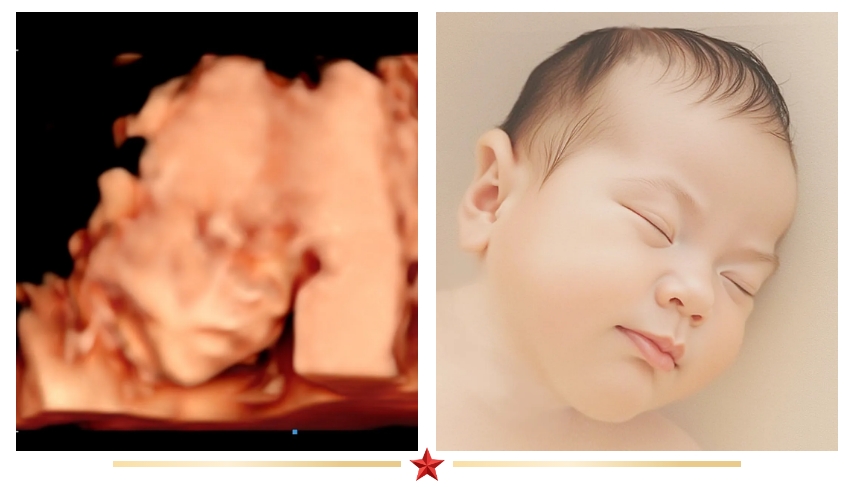 揭秘！四维彩超要耐等待的七大原因！