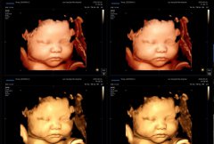 超越时光的“初见”：当5D智能彩超，为爱与期待注入安心的力量！