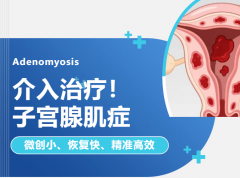 告别痛经！微创介入治疗“饿死”病灶，解决子宫腺肌症难题