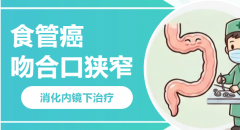 吃饭如“过关”？食管癌术后吻合口狭窄，内镜下扩张一招打通
