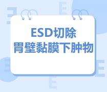 胃里发现早期病变，胃镜下ESD微创切除，损伤较小，住院时间短