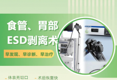 一次麻醉、一台内镜、两个病灶——消化内科完成一例食管胃双部位ESD手术