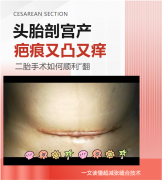 头胎剖宫产疤痕又凸又痒？二胎手术时能顺带“翻新”吗