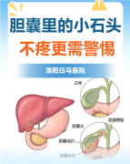 胆囊里的“沉默结石”，不疼就等于安全？医生：这些数字和特征才是关键